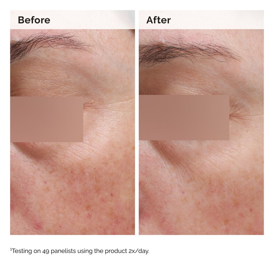 niacinamide-5-face-and-body-emulsion-o4 2024-08-23-ORD-Nia-5pct-Face-Body-B-A-Elasticity-Global-02-1x1.jpg