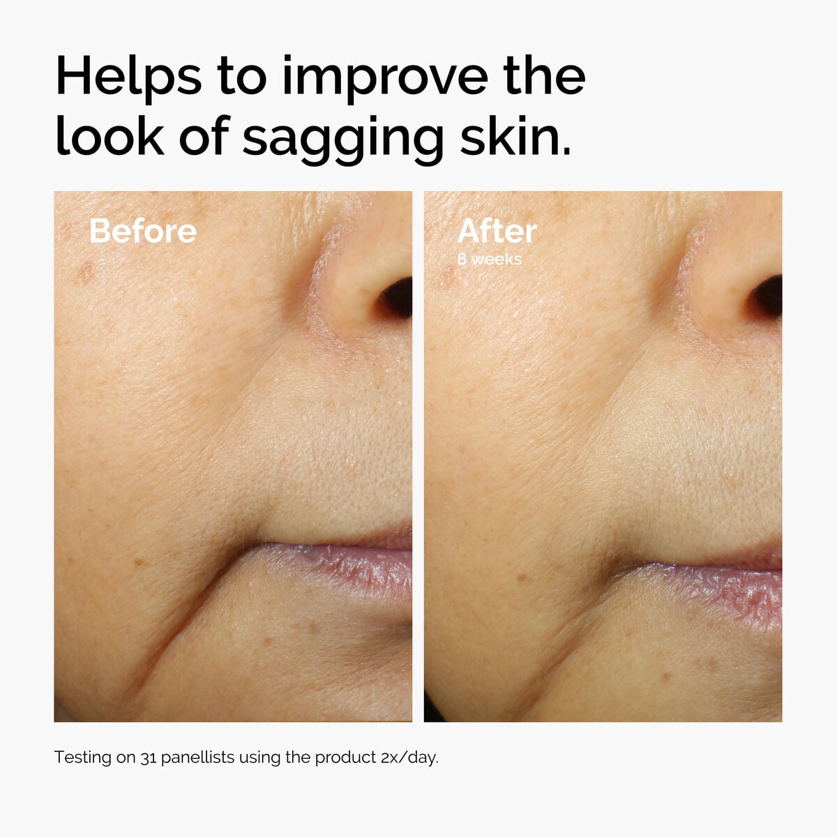 caffeine-3-escin-1-face-serum-e4 ord-caffeine-3pct-escin-1pct-face-serum-before-after-sagging.jpg