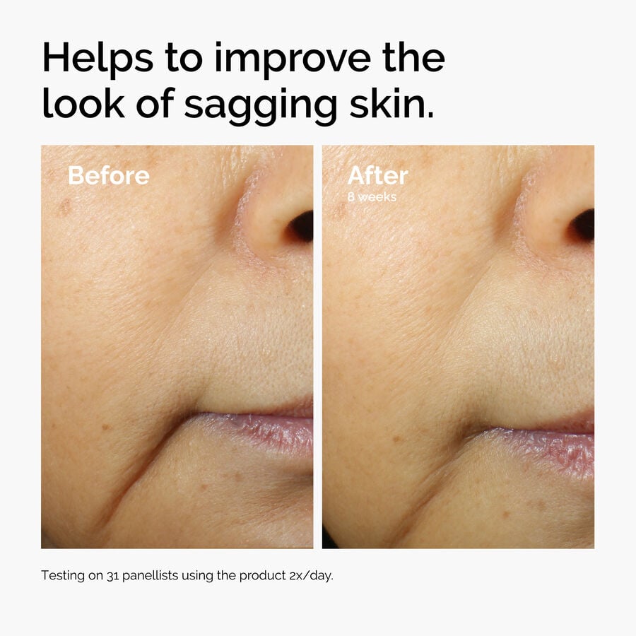 caffeine-3-escin-1-face-serum-e4 ord-caffeine-3pct-escin-1pct-face-serum-before-after-sagging.jpg