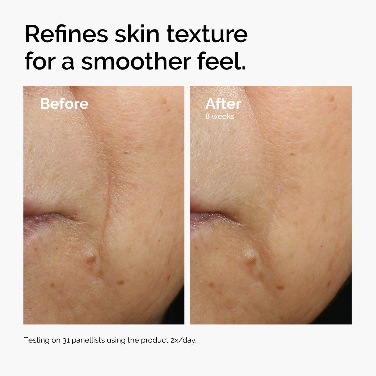 caffeine-3-escin-1-face-serum-e4 ord-caffeine-3pct-escin-1pct-face-serum-before-after-texture.jpg