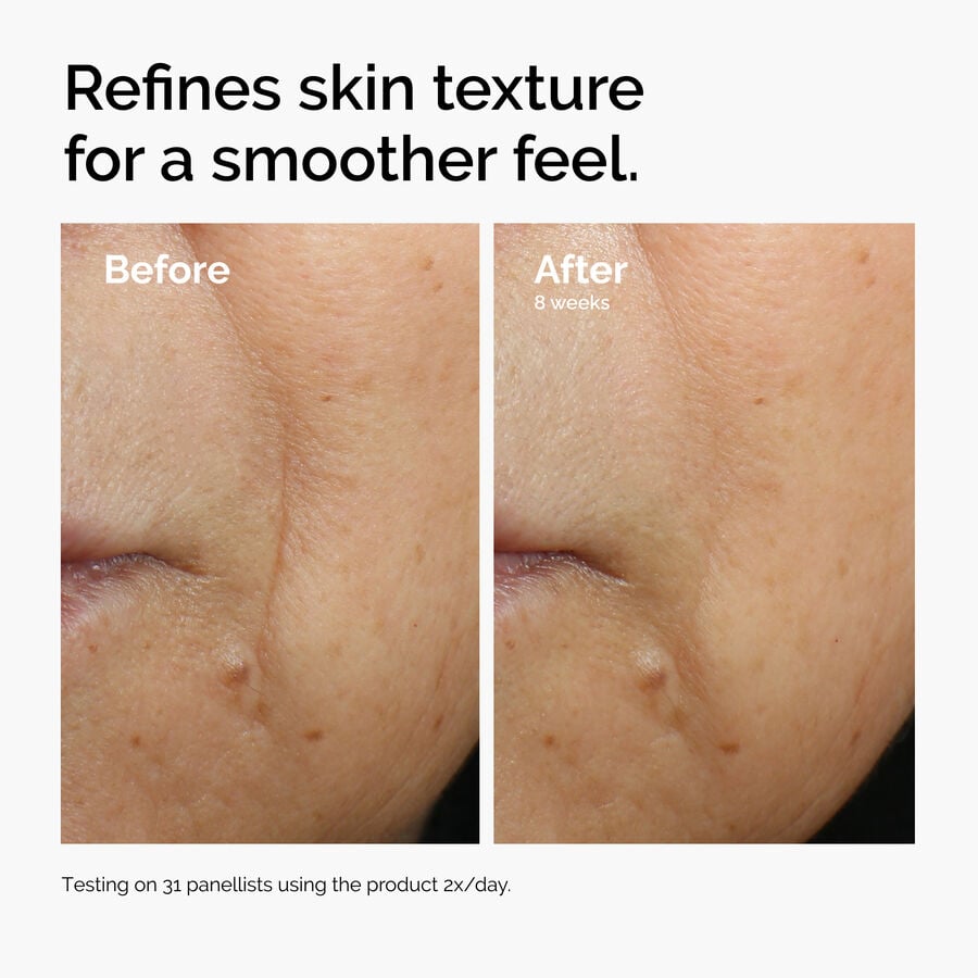 caffeine-3-escin-1-face-serum-e4 ord-caffeine-3pct-escin-1pct-face-serum-before-after-texture.jpg