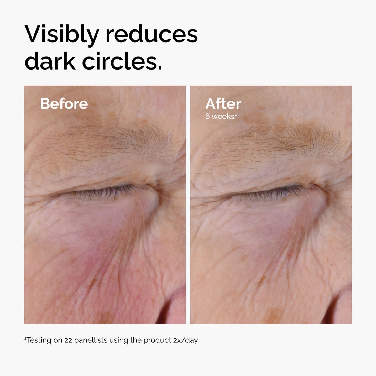 caffeine-solution-5-egcg-eye-serum-e7 ord-caffeine-solution-egcg-dark-circles-before-after.jpg