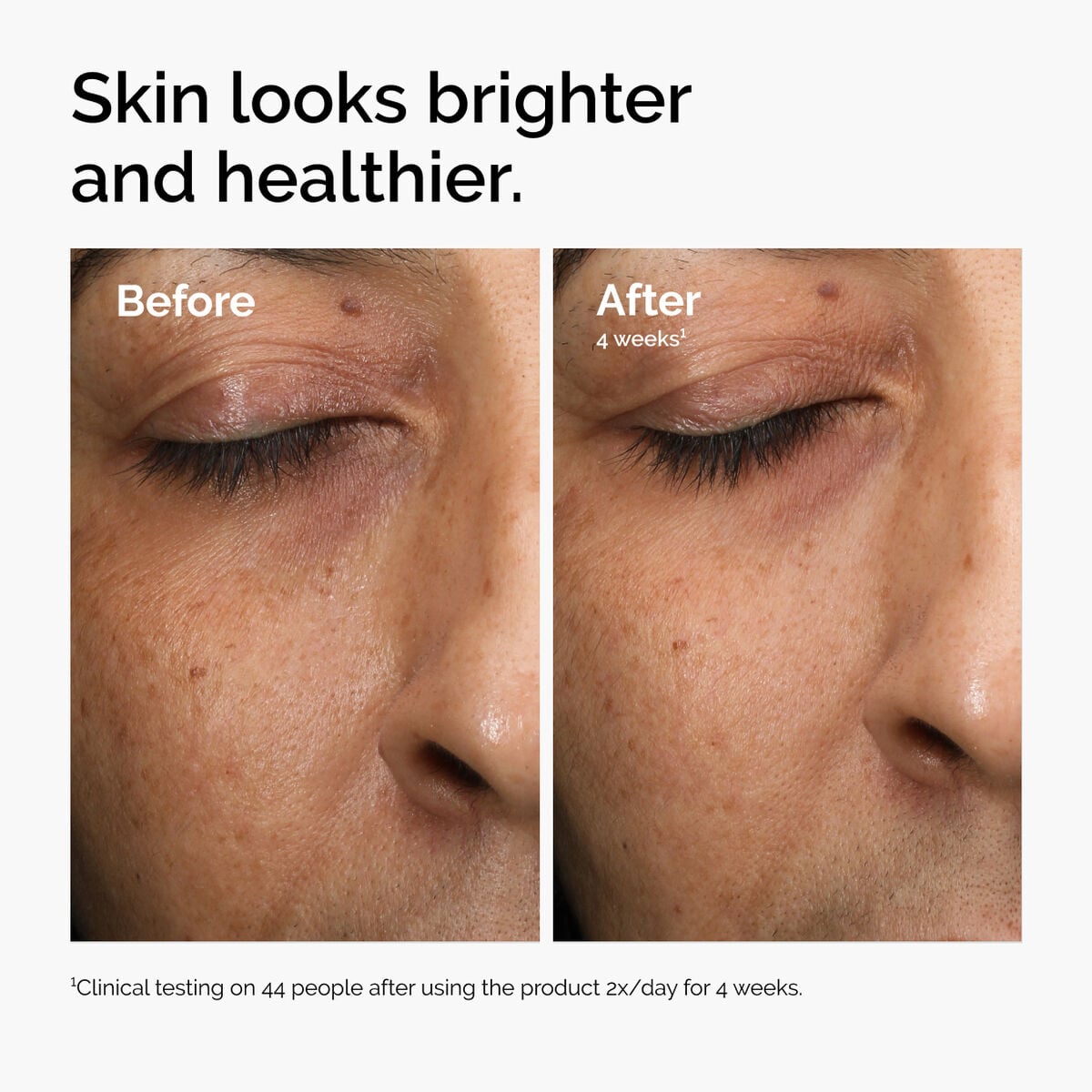 multi-antioxidant-radiance-serum-h1 ord-mars-before-after-healthy.jpg