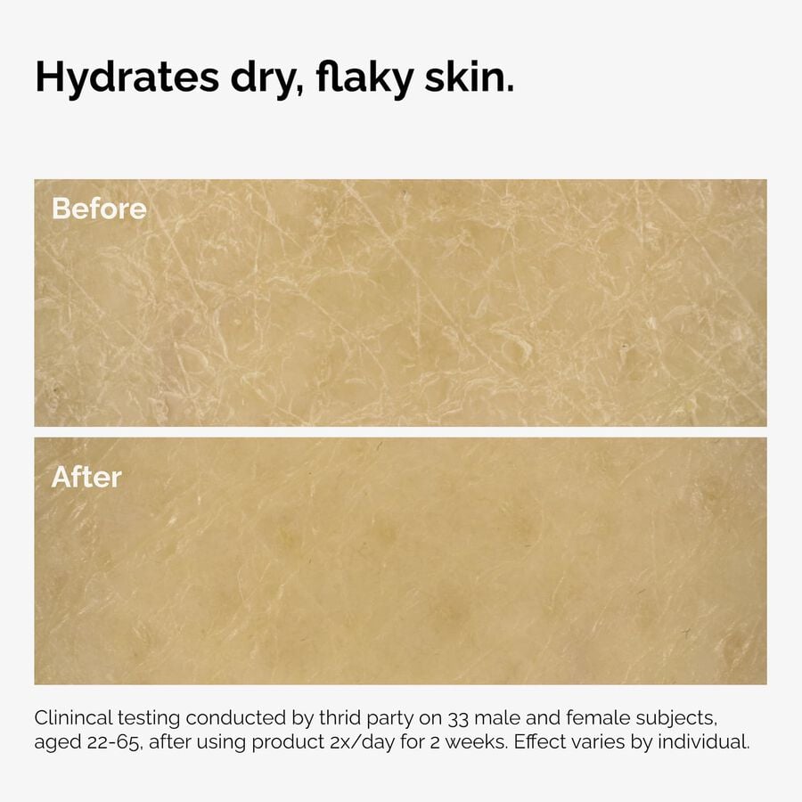 the-body-care-collection-x6 ord-natural-moisturizing-factors-inulin-body-before-after-graphic-02.jpg