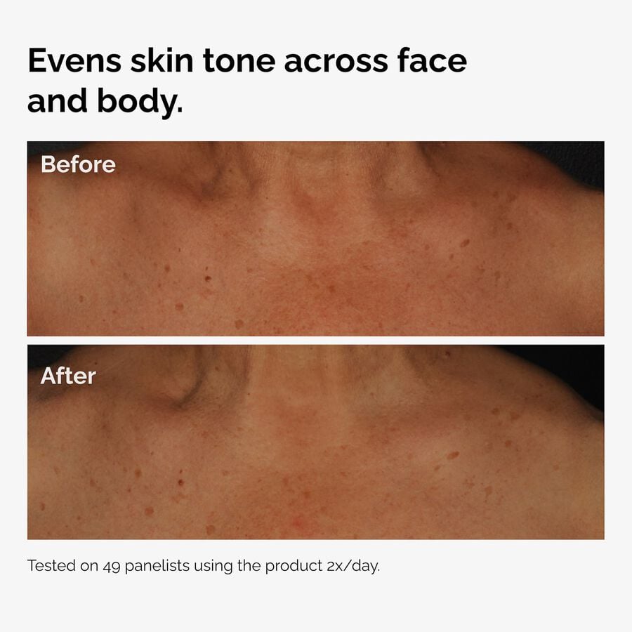 the-body-care-collection-x6 ord-niacinamide-face-body-serum-before-after-even-tone-graphic.jpg