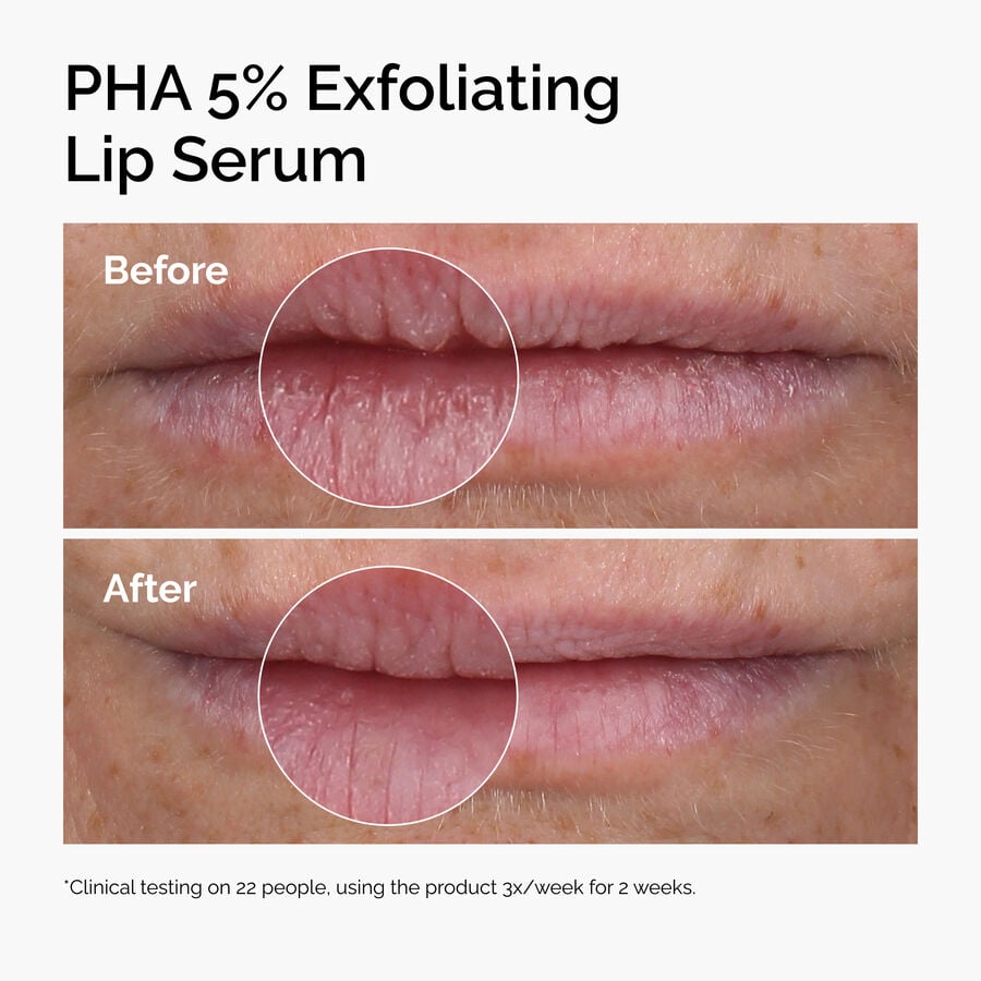 pha-5-exfoliating-lip-serum-l5 ord-pha-5pct-lip-exfoliating-serum-before-after.jpg