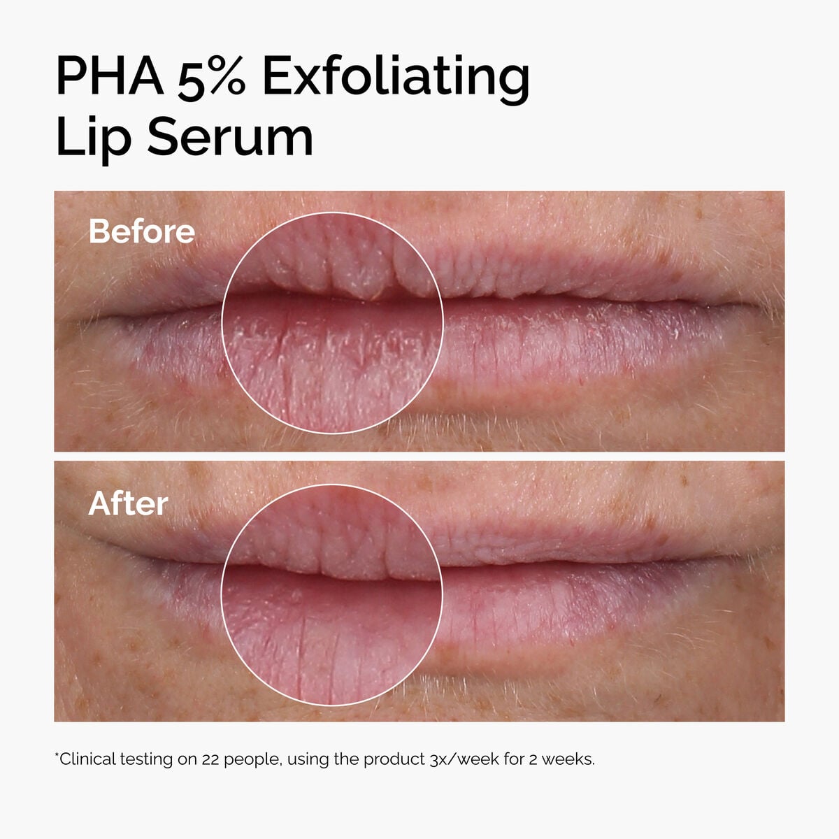pha-5-exfoliating-lip-serum-l5 ord-pha-5pct-lip-exfoliating-serum-before-after.jpg