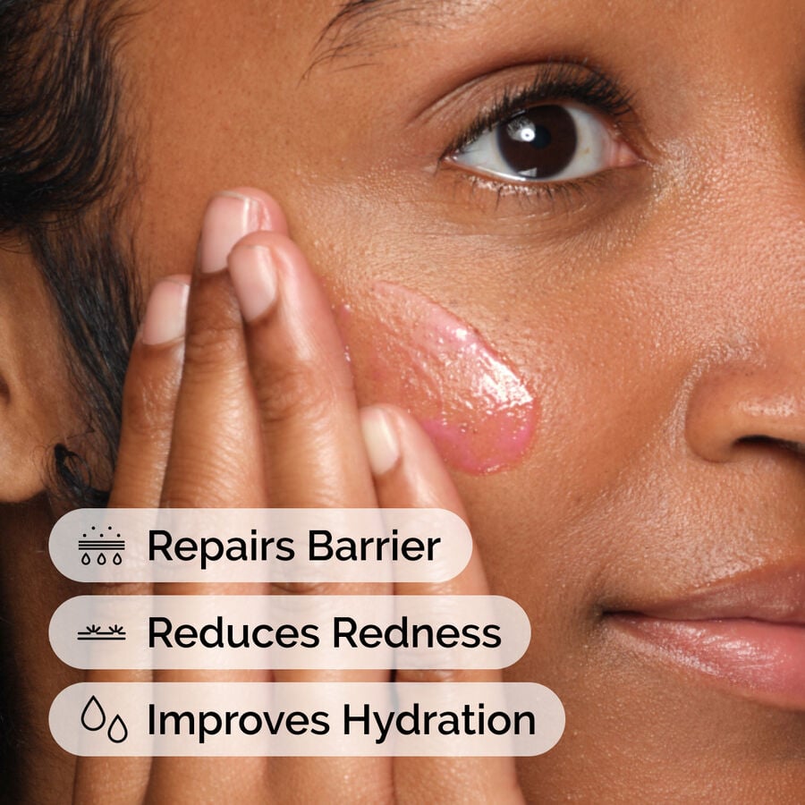 soothing-and-barrier-support-serum-set-v8 ord-soothing-barrier-support-serum-model-application-with-benefits.jpg