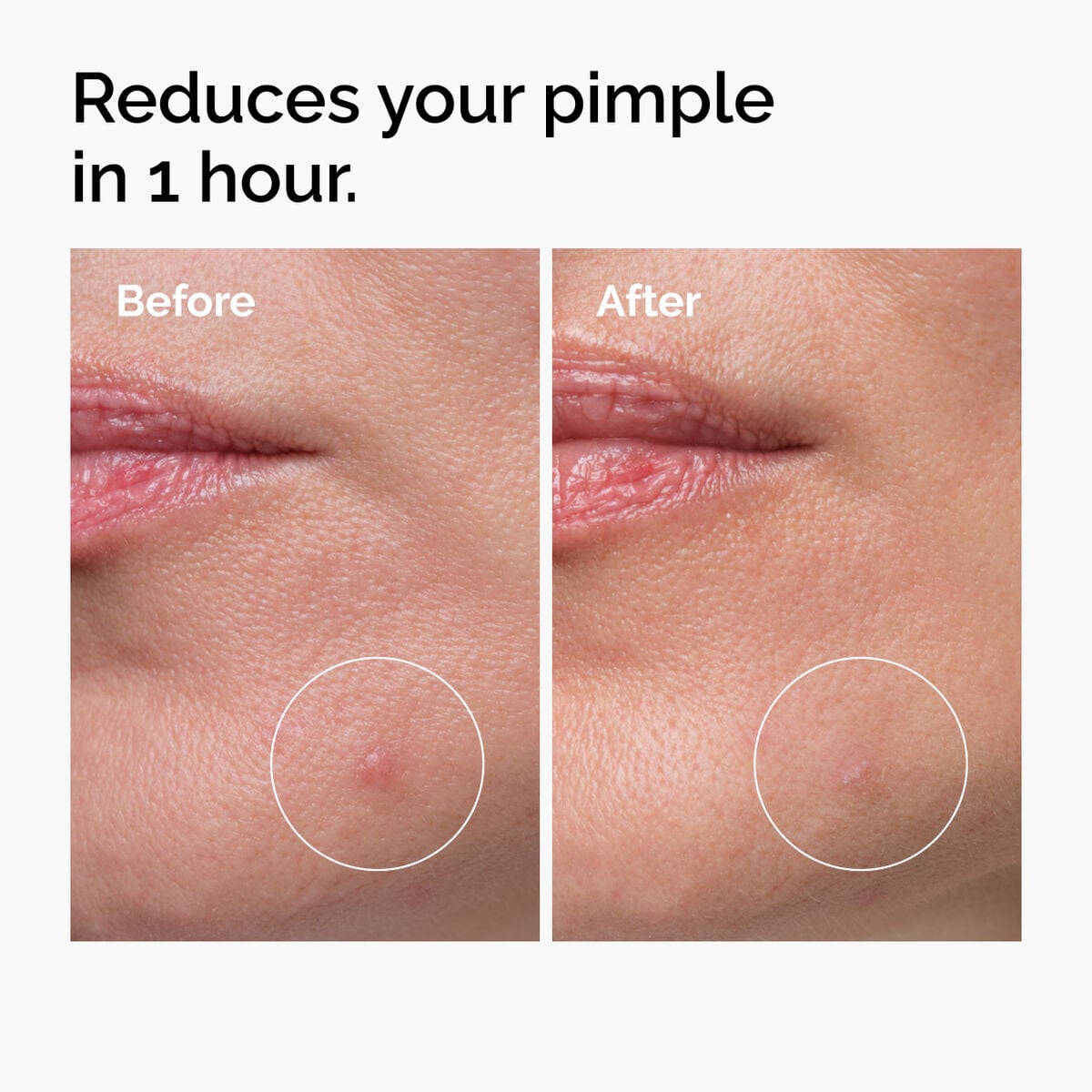 sulfur-10-powder-to-cream-concentrate-a6 ord-sulfur-10pct-powder-to-cream-concentrate-before-after-NA.jpg